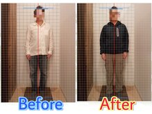 キンマク 松山院(KINMAQ)/姿勢の変化