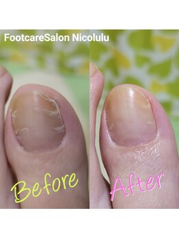 ニコルル 高崎パルクハナミズキ店(Nicolulu)/段差のある爪もお任せください♪