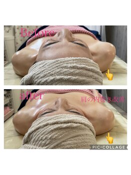 ティアラ/次世代コルギ