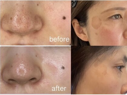 セモンプラスの写真