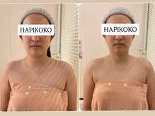 ハピココ(HAPIKOKO)/華奢みえコルギ
