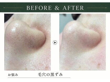 アディッシモ(addissimo)の写真