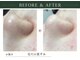 アディッシモ(addissimo)の写真
