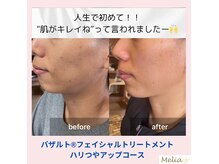 リラクゼーションサロン メリア(Melia)の雰囲気（マタニティと美肌サポートの実績がメディアに掲載されました！）