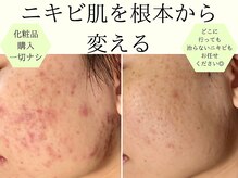 サロンドエルサ(Salon de ELSA)