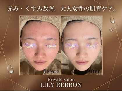 リリーリボン(LILY REBBON)の写真