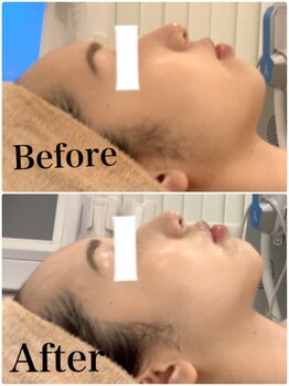 スペチアーレ 夙川/ファンデ不要の陶器肌