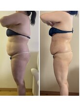 シェリラソワン(Che'rie La Soin)/ビフォーアフター