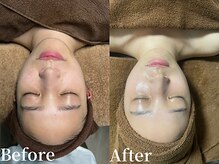 プレジール(plasir)/本気の肌質改善サロンです！