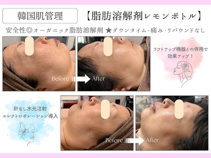 フレイヤ(FREYA)の写真