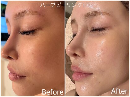 アムールドゥ 麻布十番(Amour deux)の写真