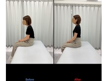 整体リアン 天神院(Lien)/ビフォーアフター：座位姿勢