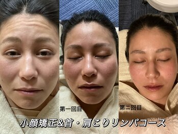 ラクフク(RAKUFUKU)/☆小顔矯正&首・肩こりリンパ☆