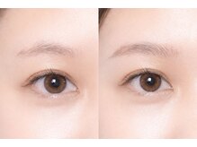 アリュールボーテ 木更津請西店(ALLURE BEAUTE)