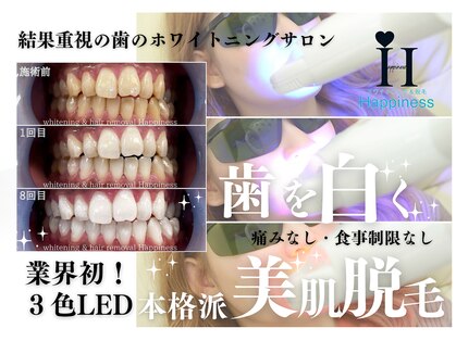 ハピネス 心斎橋アメリカ村本店(Happiness)の写真