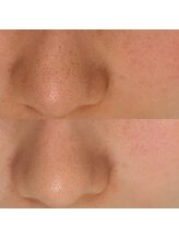 ミニョンプラス(Mignon+)/お化粧ノリupうるツヤ肌