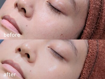 アルムボーテ 代官山 恵比寿(ARUIM Beaute)/肌の透明感アップ[代官山]