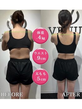 ビーナス 恵比寿店(venus)/猫背を改善して背中美人へ