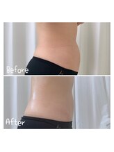 サロンドビオ(Salon de vio)/温腸活