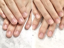 リファーレ(RIFARE)/【深爪矯正】貝爪さんも伸びる！