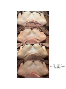 ロココ 豊田店(Rococo)/ビフォーアフター