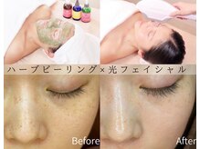 インディビューティー 六本木店(inde beauty)の雰囲気（満足度NO1シミ・くすみ改善♪透明肌+理想の素肌へ◎22000→14800）