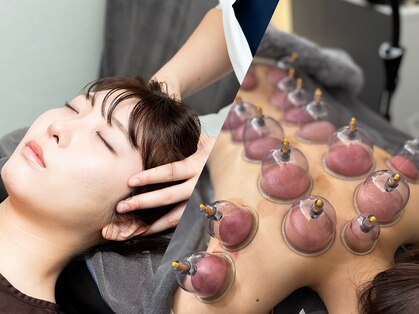 ジャントエース(JANTACE)の写真