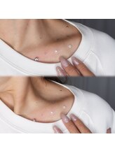 ココロビューティーギャラリー 武蔵小杉(cocorobeauty gallery)/デコルテジュエリー