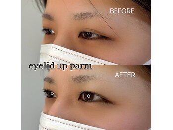 プリティアイ(pretty eye)/特許技術アイリッドアップパーマ