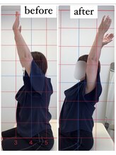 ナオル整体 仙台長町院(NAORU整体)/整体・矯正ビフォーアフター