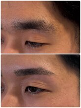 スリーピース(3Peace)/Before/After