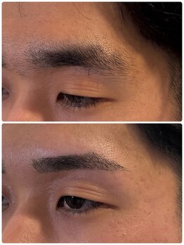 スリーピース(3Peace)/Before/After