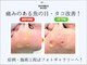 巻き爪補正店 鎌倉大船店の写真/プロの技で硬い角質を取り除き、なめらかな足裏と美爪に[トータル足裏角質ケア＋足の爪切りセット￥8250]