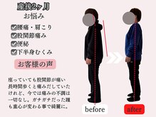 アオラド(Aolado)/辛い腰痛