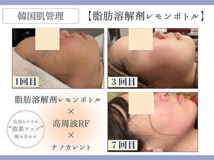 フレイヤ(FREYA)の写真