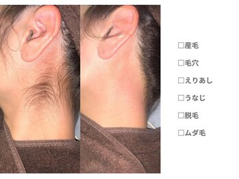 ピュアノア 垂水店/えりあし脱毛  神戸垂水明石