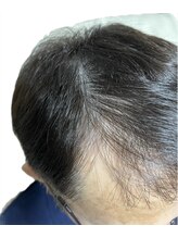 リセル(Recell)/育毛促進ケア