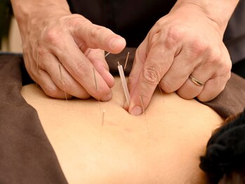 国分寺カケル整骨院 鍼灸院の写真/《鍼灸で美と健康両面でサポート》腰痛/肩こり/たるみ・シワケア/自律神経/眼精疲労等お悩みに合わせ施術◎