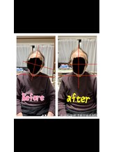 エンジョイエクササイズ整体院 武蔵新城(enjoyEXERCISE整体院)/Before、After