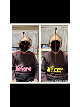 エンジョイエクササイズ整体院 武蔵新城(enjoyEXERCISE整体院)/Before、After