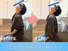 鍼灸整体院ワト 三軒茶屋院(鍼灸整体院WATO)/■姿勢のお悩みご相談ください