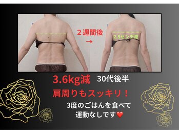 スマイルデイズ(Smiledays)/2週間でもこんなに綺麗に♪