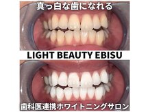 ライトビューティー 恵比寿店(LightBeauty)