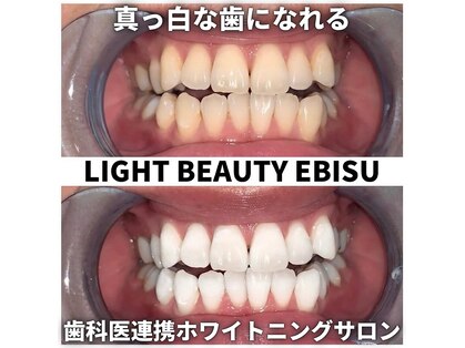 ライトビューティー 恵比寿店(LightBeauty)の写真