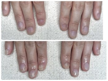 カフナ アンド チル(Kahuna&chill)の写真/深爪矯正で自然な美爪へ導く、船橋ネイルサロン!自爪育成×悩み解消ケアも◎爪状態に合わせた丁寧な施術