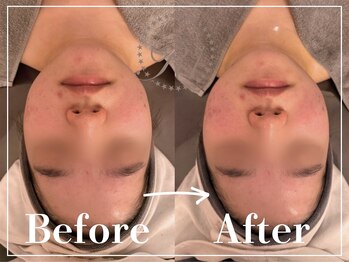 R-1ビューティーサロン 表参道/Before＆After