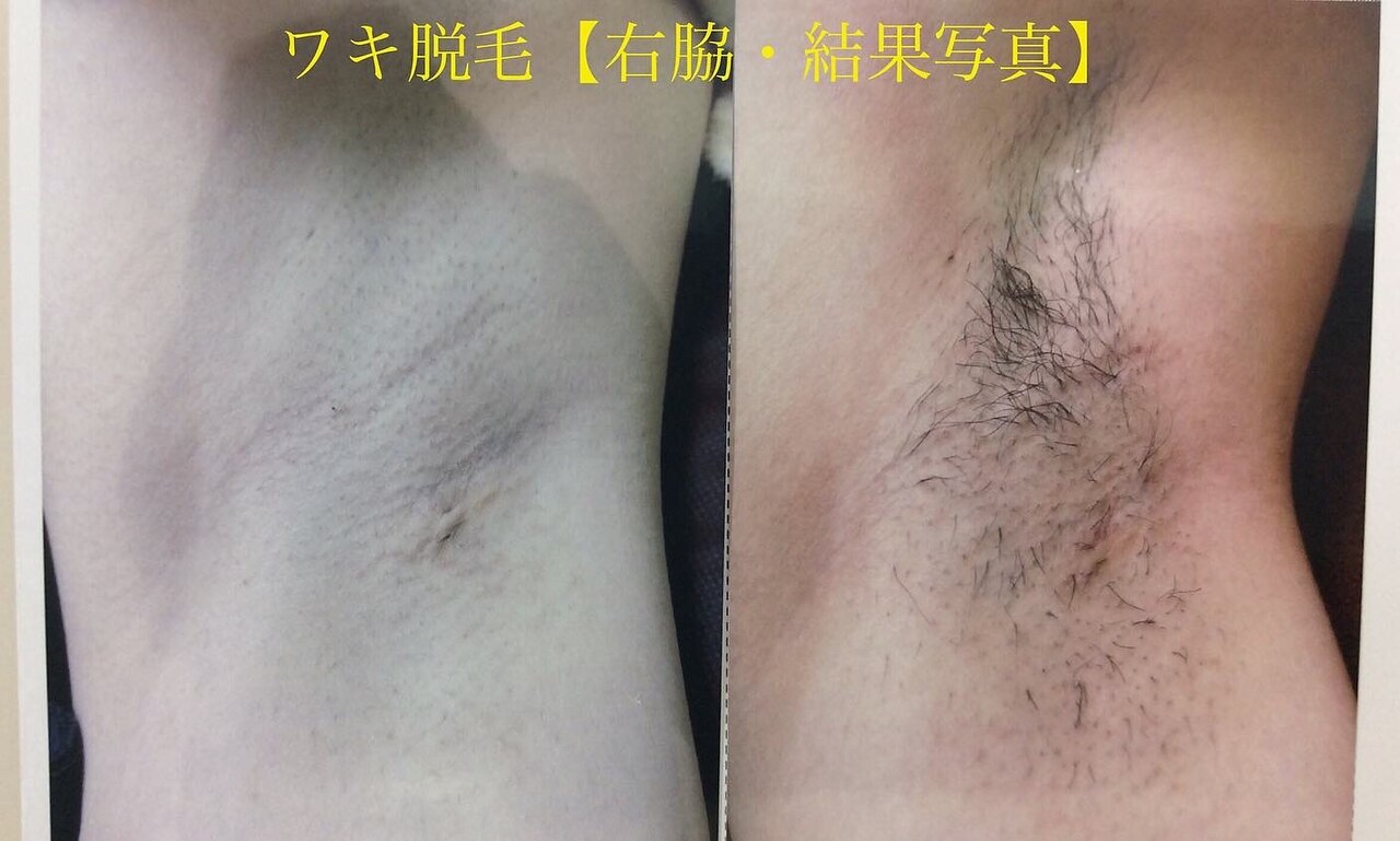 ヘアケア 【約15000円分】未開封ビューティクリニックコダマ購入 化粧品