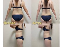 ビードットティアラ(Be.Tiara)/ハイパーナイフ