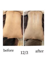 メルシートータルビューティー(MERCI)/