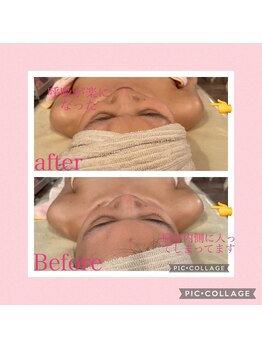 ティアラ/次世代コルギ